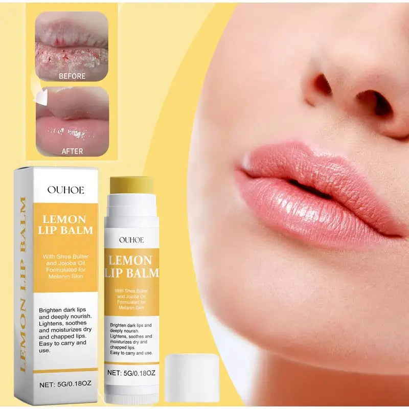 Fruit Lip Balm Set