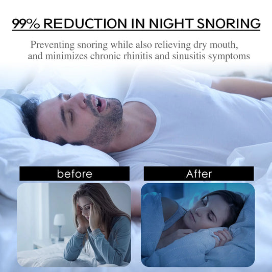 Anti-Snoring Patch Nose Breathing Correction Improve Sleeping Promoting Better Breath