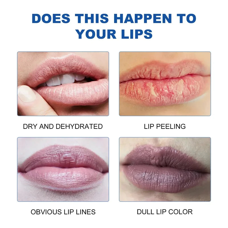 Remove Dark Lip Balm
