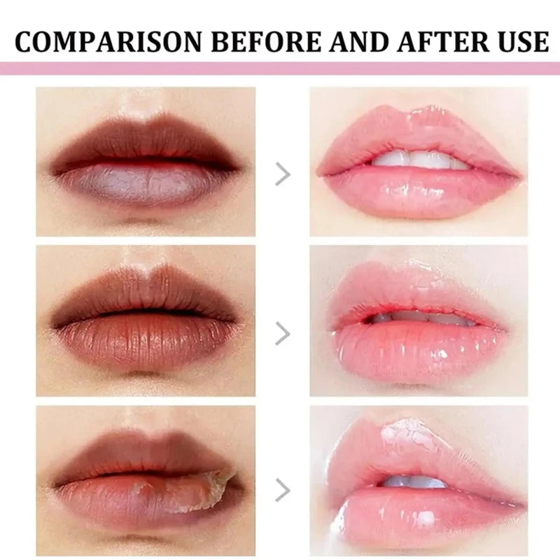 Fruit Lip Balm Set