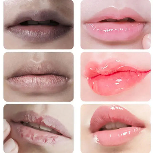 Fruit Lip Balm Set