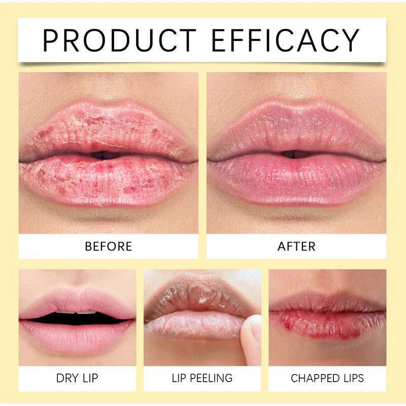 Fruit Lip Balm Set