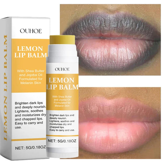 Fruit Lip Balm Set